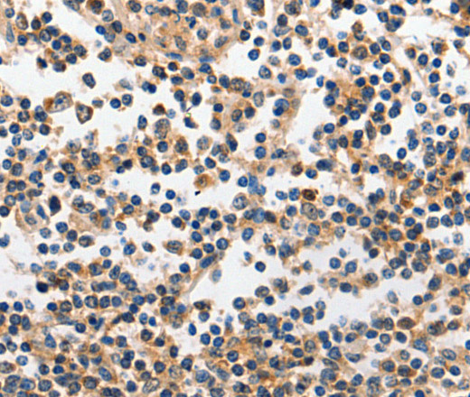 INHA Polyclonal Antibody (E-AB-10398)