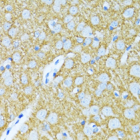 SYP Polyclonal Antibody (E-AB-62937)