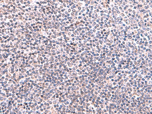 KIR3DL1 Polyclonal Antibody (E-AB-19041)