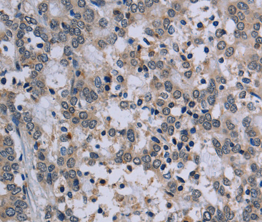 TP53AIP1 Polyclonal Antibody (E-AB-13486)