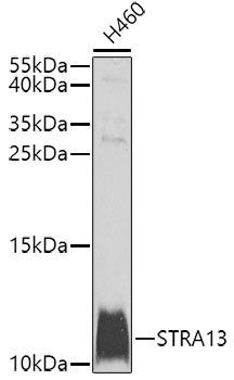 STRA13 Polyclonal Antibody (E-AB-62582)