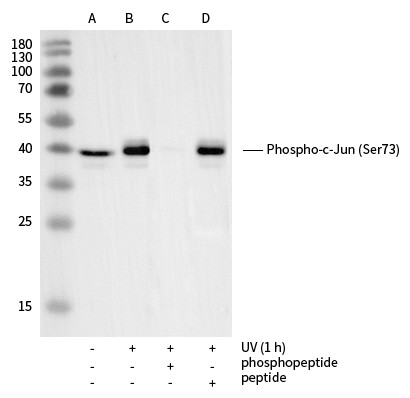 Recombinant Phospho-c-Jun (Ser73) Monoclonal Antibody (AN300154L)