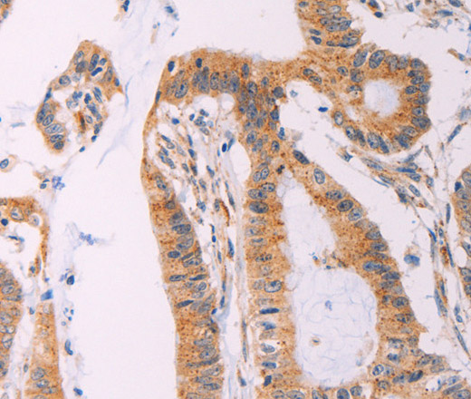 ADCY1 Polyclonal Antibody (E-AB-16138)