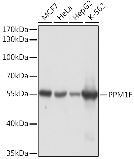 PPM1F Polyclonal Antibody (E-AB-91134)