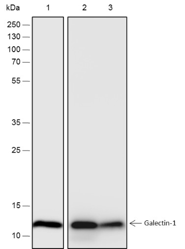 Recombinant Galectin-1 Monoclonal Antibody (AN301528L)