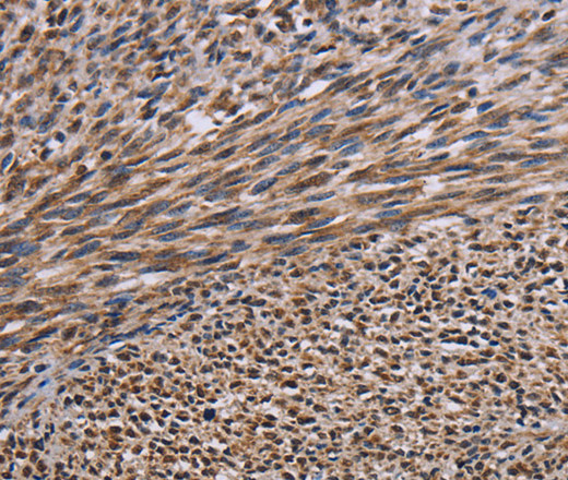 KIF2A Polyclonal Antibody (E-AB-15157)