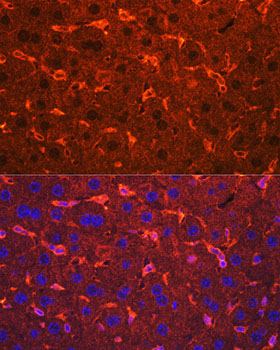 Ceruloplasmin Polyclonal Antibody (E-AB-90643)