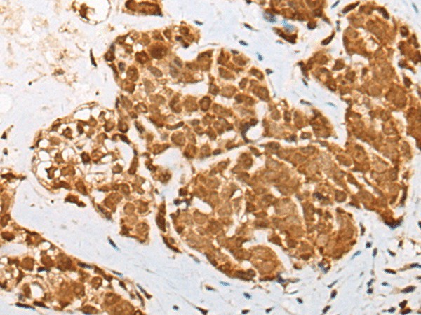 ATN1 Polyclonal Antibody (E-AB-53586)