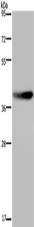 MKP-2 Polyclonal Antibody (E-AB-14071)