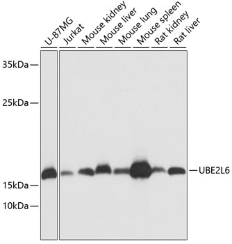 UBE2L6 Polyclonal Antibody (E-AB-64780)