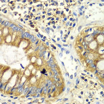 PICK1 Polyclonal Antibody (E-AB-64726)