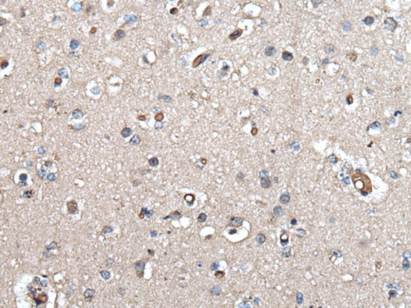 UMPS Polyclonal Antibody (E-AB-18508)