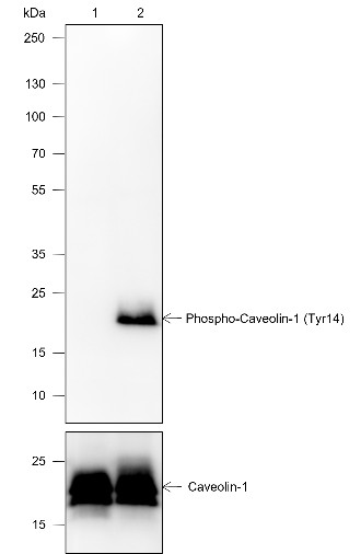 Recombinant Phospho-Caveolin-1 (Tyr14) Monoclonal Antibody (AN302089L)