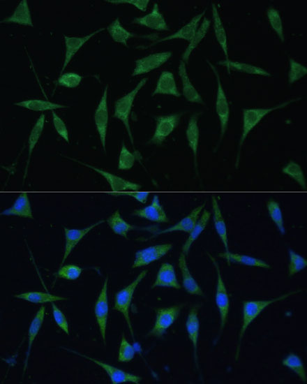 PALD1 Polyclonal Antibody (E-AB-64362)