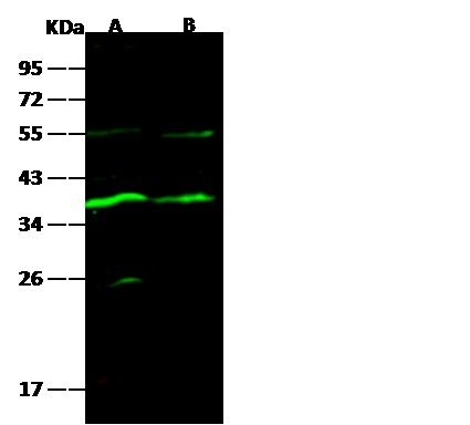 Recombinant Carbonic Anhydrase VIII/Car8 Monoclonal Antibody (AN300558P)