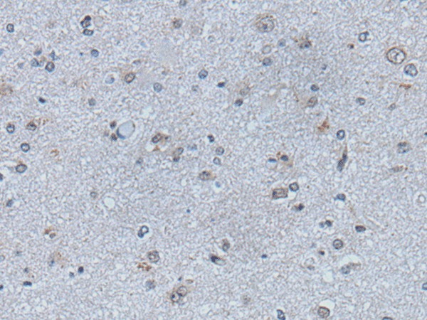 EFNB1 Polyclonal Antibody (E-AB-53525)