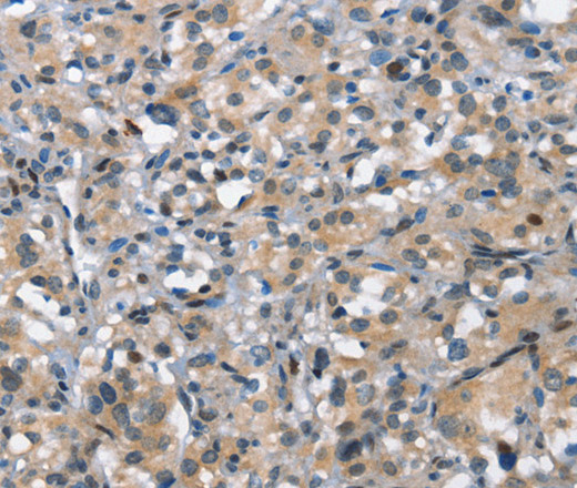 DDR2 Polyclonal Antibody (E-AB-15973)