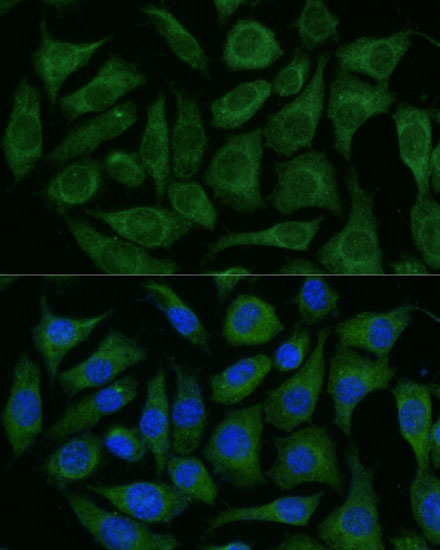 RAPGEF1 Polyclonal Antibody (E-AB-66670)