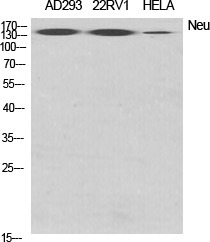 ERBB2 Polyclonal Antibody (E-AB-32198)