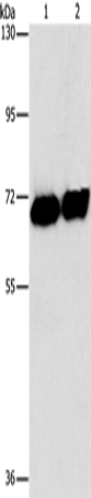 Placental Alkaline Phosphatase Polyclonal Antibody (E-AB-14764)