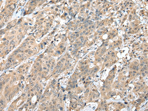 HIF1A Polyclonal Antibody (E-AB-52265)