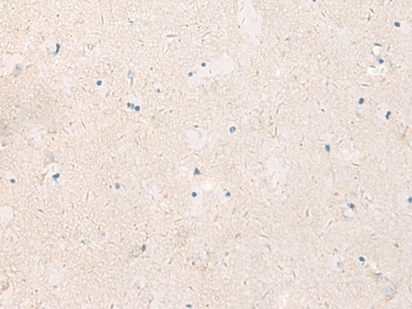 KCNIP3 Polyclonal Antibody (E-AB-19200)