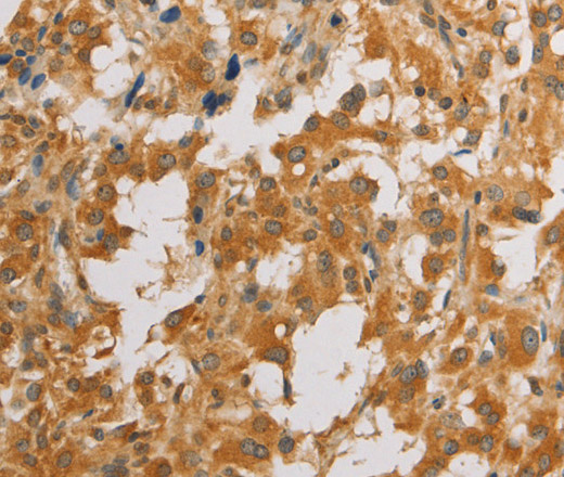 ATG4D Polyclonal Antibody (E-AB-10860)