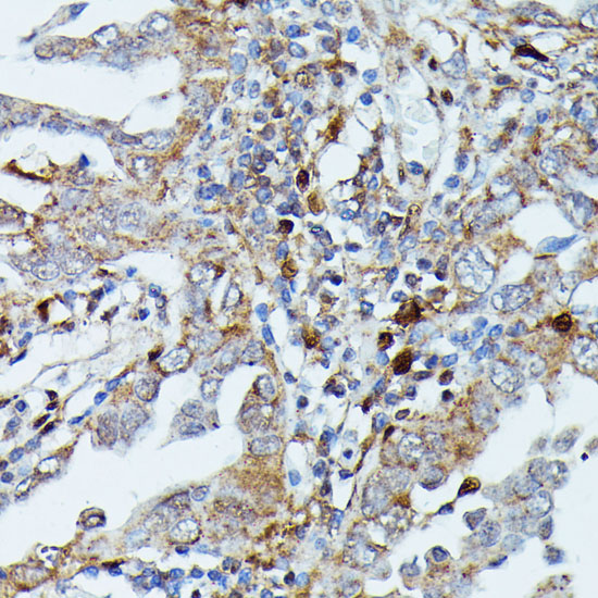 MAP3K3 Polyclonal Antibody (E-AB-66675)