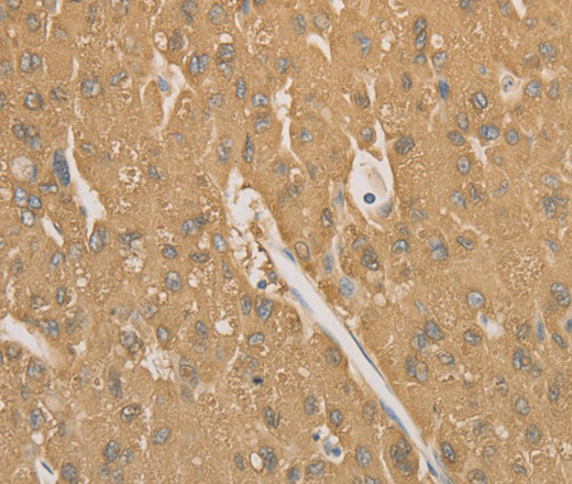 CD40 Polyclonal Antibody (E-AB-16318)