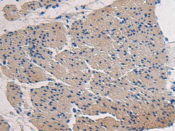 COL17A1 Polyclonal Antibody (E-AB-17809)
