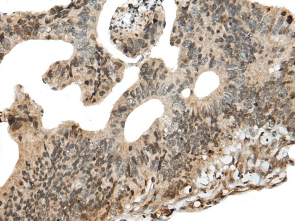 CALML5 Polyclonal Antibody (E-AB-52512)