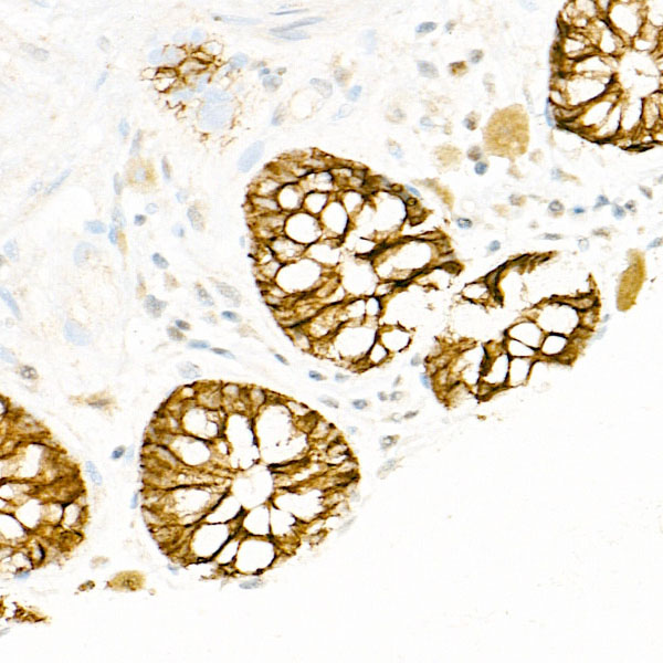 FXYD3 Polyclonal Antibody (E-AB-92219)