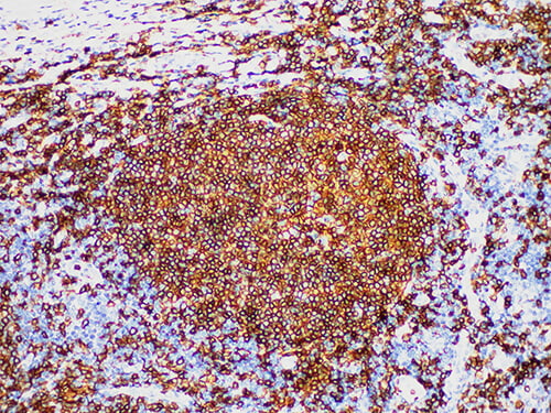CD20 Monoclonal Antibody (ELAB6149-M)