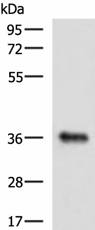 GRHPR Polyclonal Antibody (E-AB-18054)