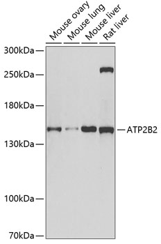 ATP2B2 Polyclonal Antibody (E-AB-61379)