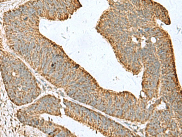 CDC20 Polyclonal Antibody (E-AB-52980)