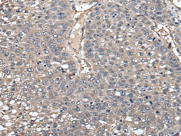 GCNT2 Polyclonal Antibody (E-AB-52277)