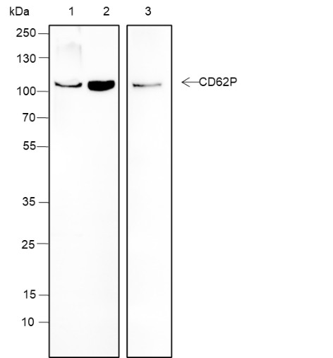Recombinant CD62P Monoclonal Antibody (AN301485L)