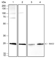 Recombinant BAG2 Monoclonal Antibody (AN301757L)