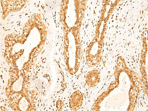 ZNF471 Polyclonal Antibody (E-AB-18880)