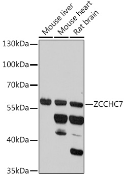 ZCCHC7 Polyclonal Antibody (E-AB-92005)