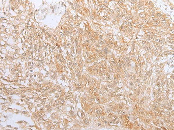 ZNF34 Polyclonal Antibody (E-AB-18463)