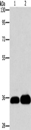 LIN28B Polyclonal Antibody (E-AB-16187)