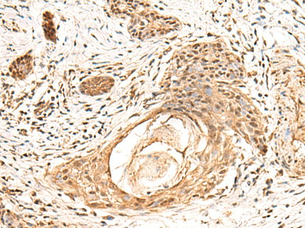 KCTD13 Polyclonal Antibody (E-AB-18981)