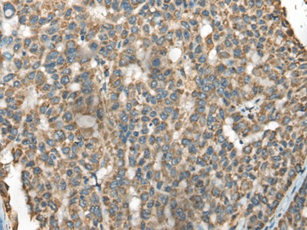 BLNK Polyclonal Antibody (E-AB-52474)