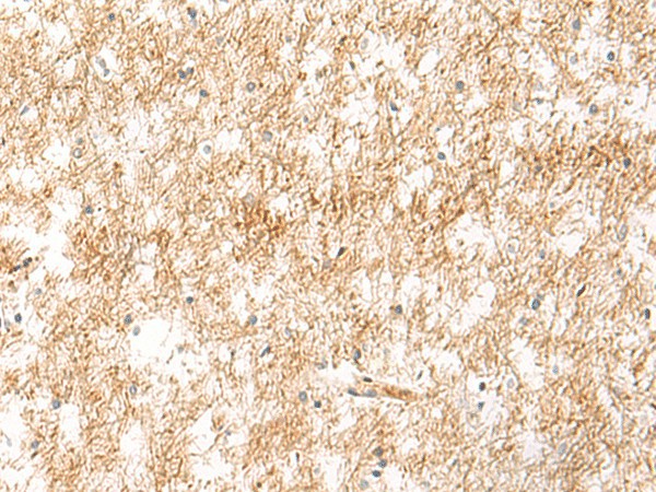 XPC Polyclonal Antibody (E-AB-53352)