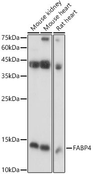 FABP4 Polyclonal Antibody (E-AB-68247)