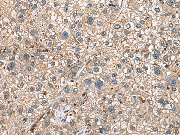 HLA-DRA Polyclonal Antibody (E-AB-17927)