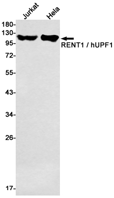 Recombinant RENT1 Monoclonal Antibody (E-AB-81603)