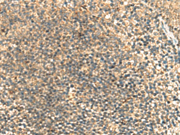 TCAP Polyclonal Antibody (E-AB-18784)